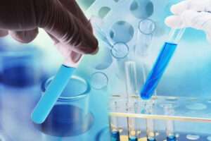 Benefits of Lab Tests at Home