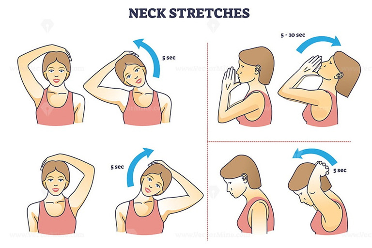 Cervical Spondylosis