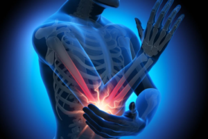 Tennis Elbow