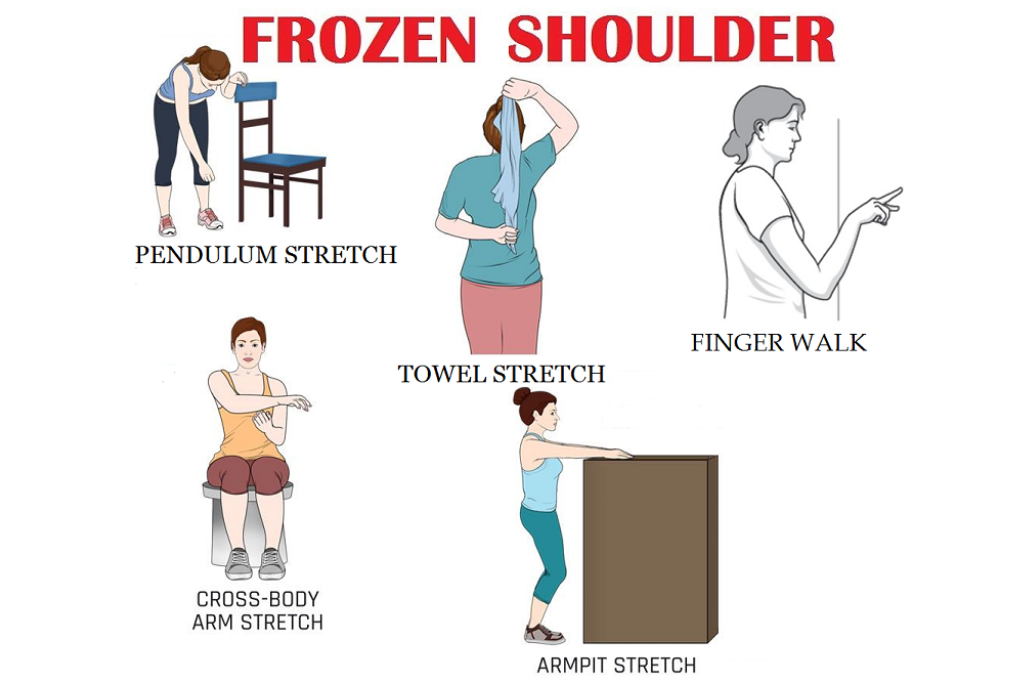 Frozen Shoulder Inhouse Blog