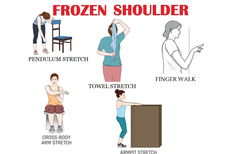 Frozen Shoulder