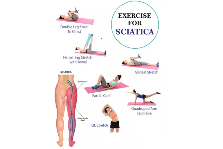 Sciatica