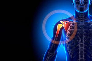 Shoulder Pain
