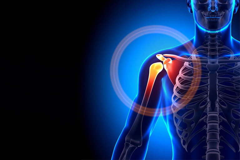 Shoulder Pain