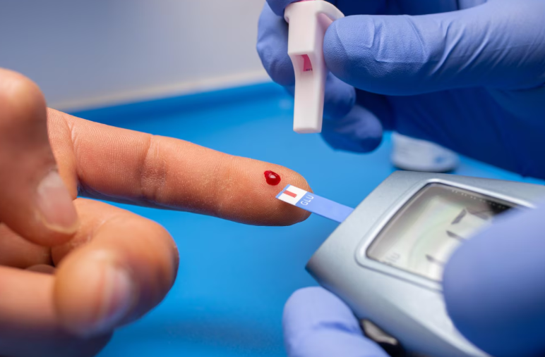 Random Blood Sugar Test at Home